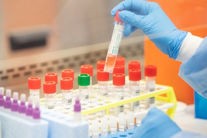 सरकारले कोरोना जाँच गर्ने केमिकल किन्न टेन्डर आह्वान गर्‍यो