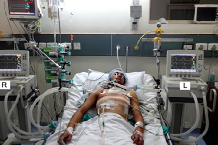 चिकित्सक भन्छन् : भेन्टिलेटरले मात्र मान्छे बचाउन सक्दैन, ५०% बिरामीको भेन्टिलेटरमै मृत्यु हुन्छ