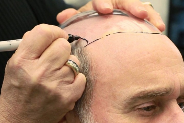 कपाल रोप्न शून्य ब्याजदरमा २ लाख ऋण पाइने !